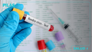 Regresó el virus Hendra